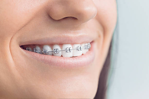 Best Invisalign and Clear Aligners  in Halfway, MD
